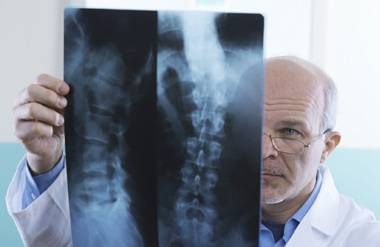 Doctor looking at spine x-ray