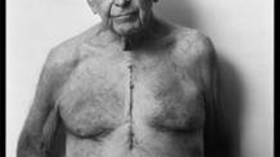 joe white standing without a shirt and a scar down his chest