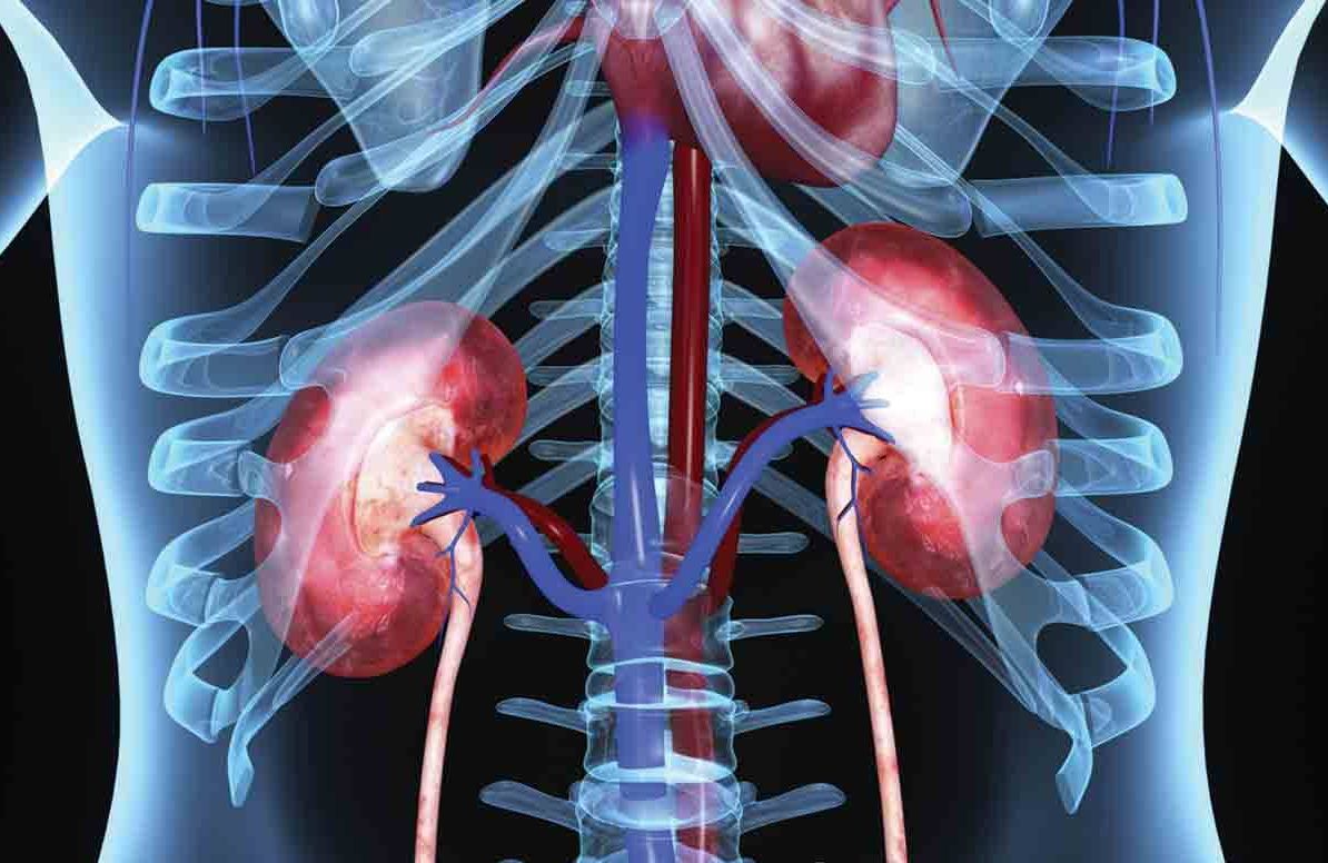 Are-You-At-Risk-for-Kidney-Disease-491325253