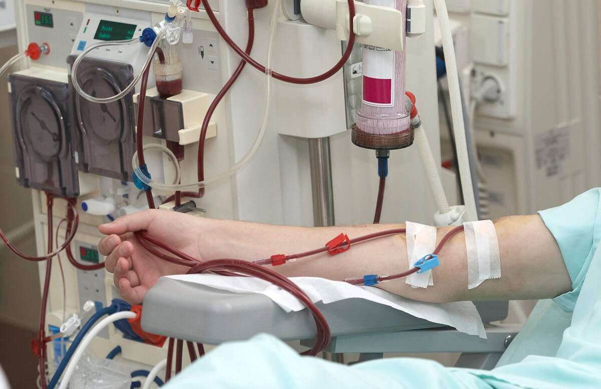 kidney dialysis