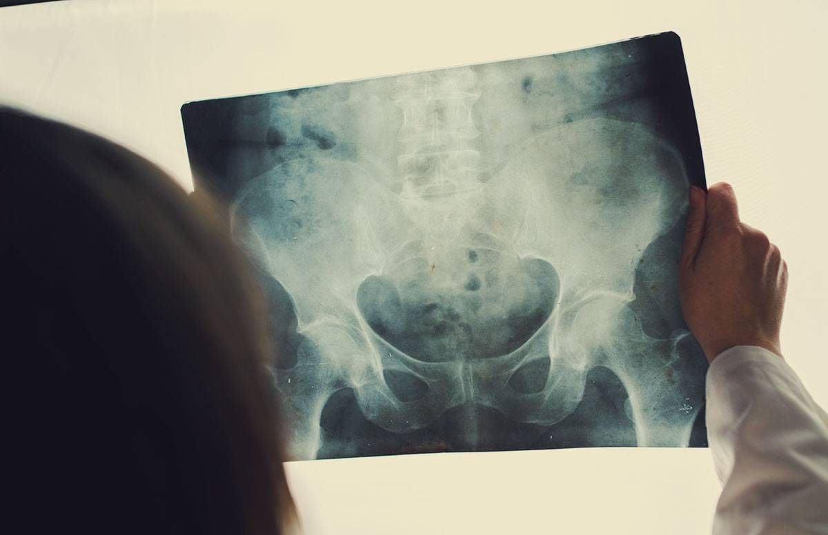Hip Xray being examined by a doctor