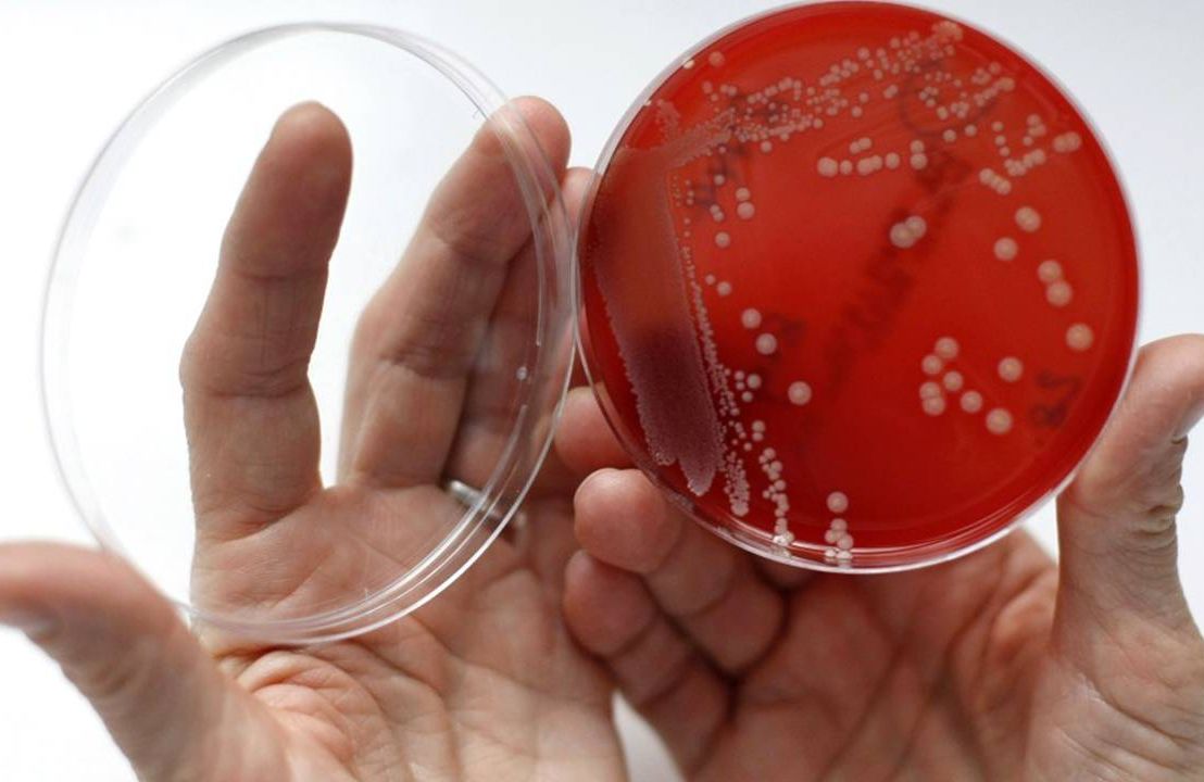 bacteria strain grown in Petri dish, superbugs, Next Avenue, antibiotic overuse