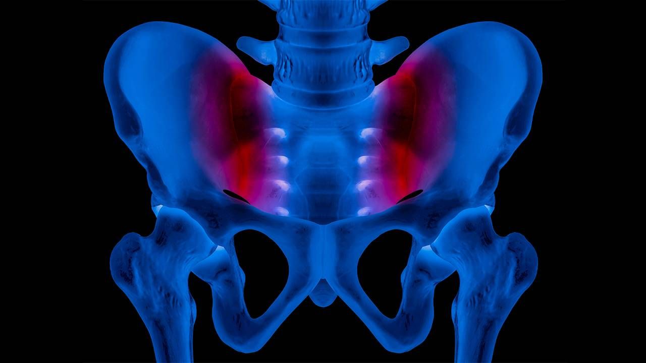 An Xray of a human pelvis highlighting the sacroliliac joint. Next Avenue, lower back pain