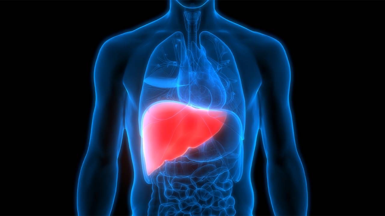 A 3D rendering of a human liver with Nonalcoholic Fatty Liver Disease or NAFLD, now known as Metabolic Associated Fatty Liver Disease MAFLD. Next Avenue