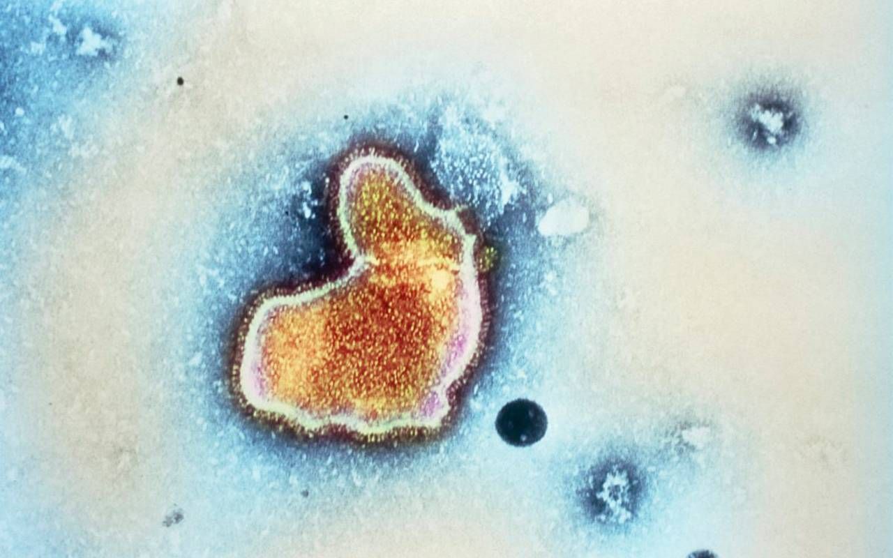 A microscopic view of a RSV virus. Next Avenue, RSV Vaccine