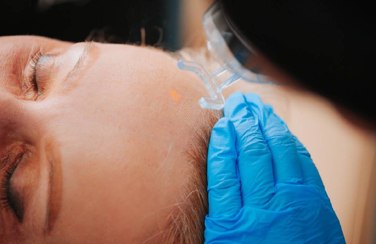 A close up shot of a woman undergoing a laser skin resurfacing treatment. Next Avenue, aging, skin