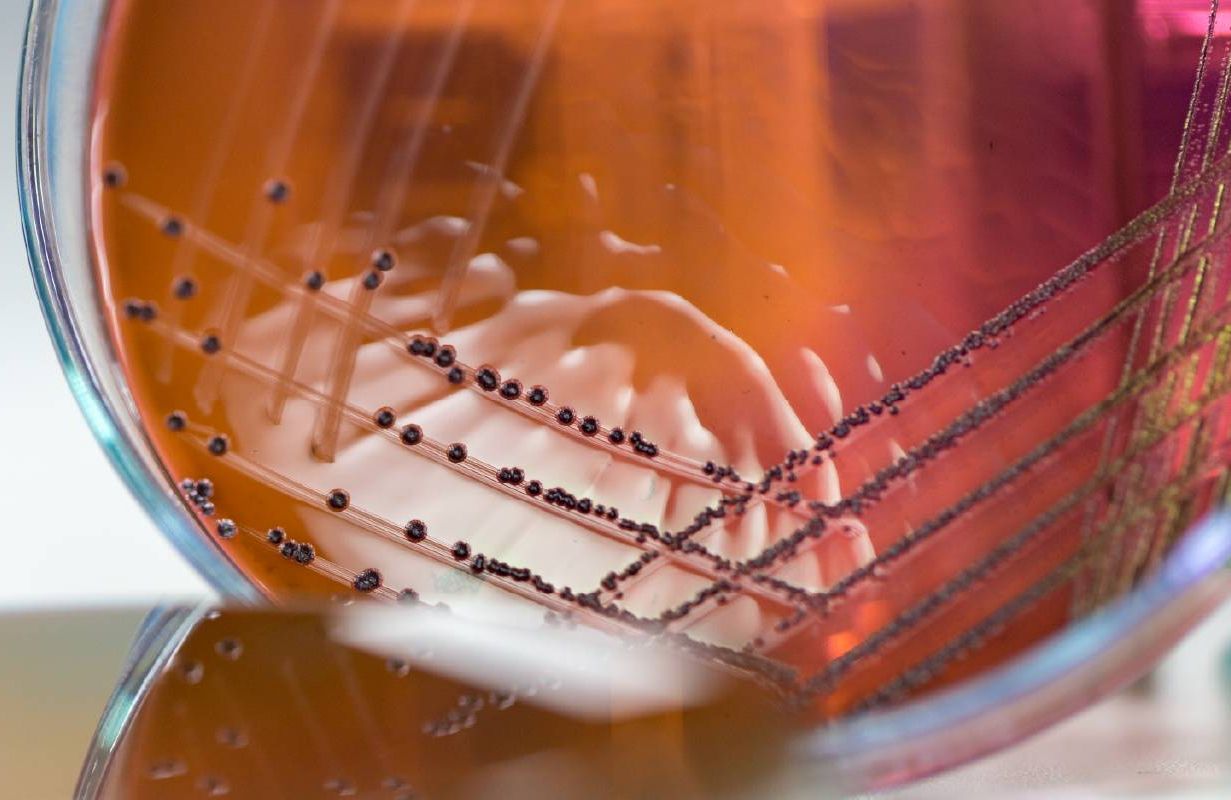 An agar dish with a bacteria sample. Next Avenue, c. diff, Clostridioides difficile, bacterial infection
