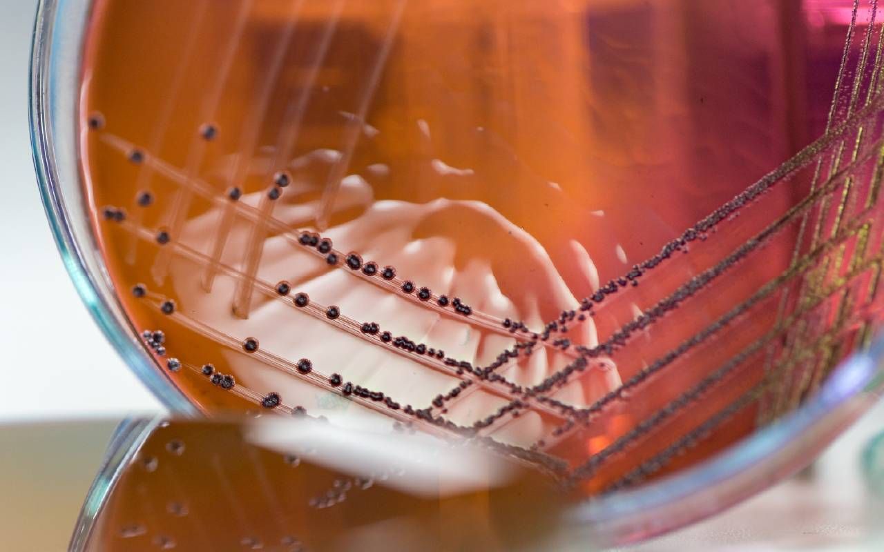 An agar dish with a bacteria sample. Next Avenue, c. diff, Clostridioides difficile, bacterial infection