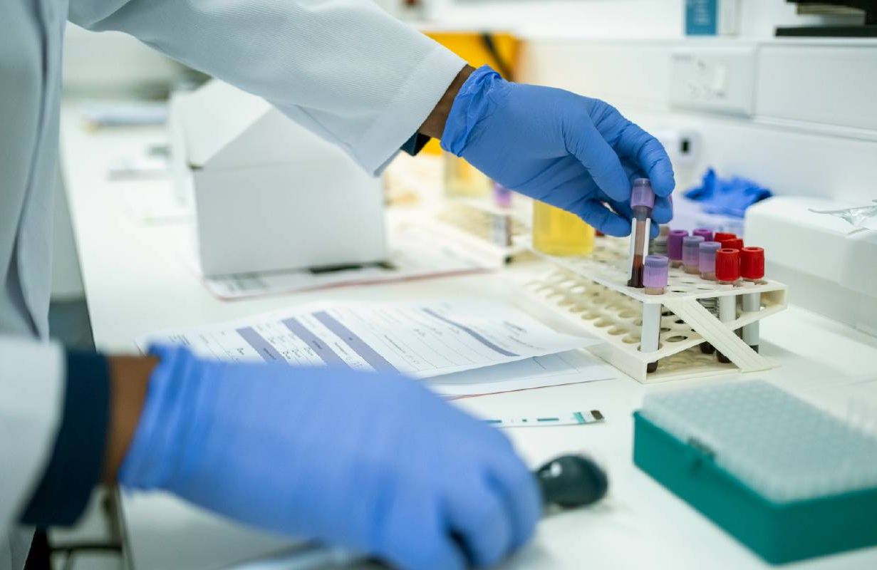 A researcher performing a blood test. Next Avenue, lymphoma, blood test, study