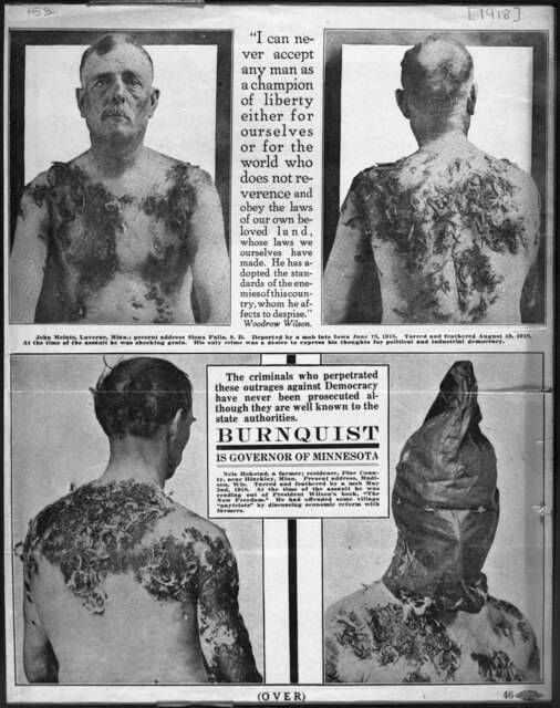Men tarred and feathered in Minnesota during 1918 campaign by anti-Nonpartisan Leaguers, c.1918.