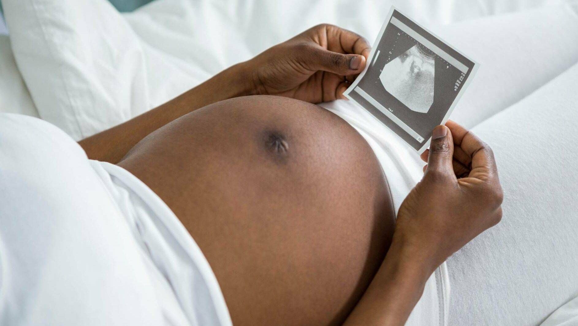 Photograph of a pregnant Black woman lying down with her stomach exposed, holding an ultrasound photo in her hands, black and pregnant in America, Rewire